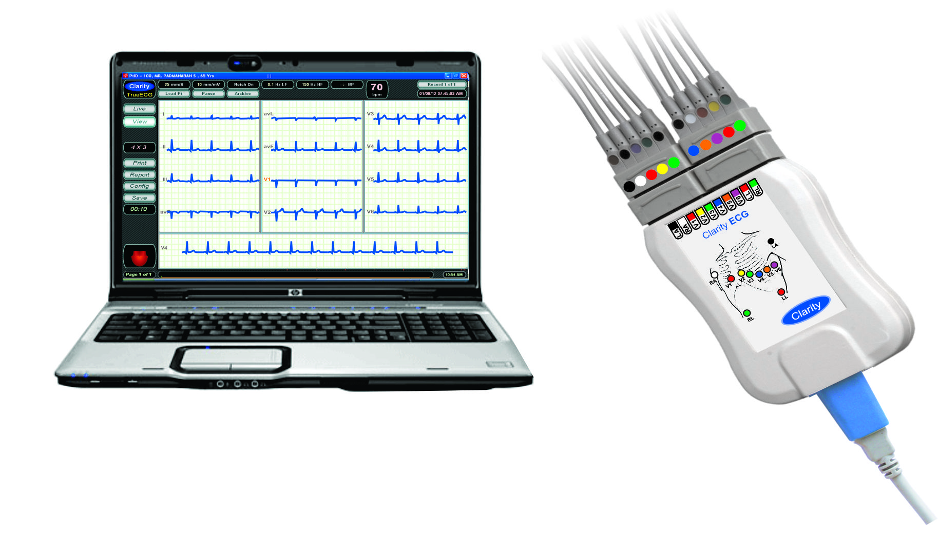 ECG,EEG.EMG,PUlseoximeter,Sytingepump,TMT,ECP,